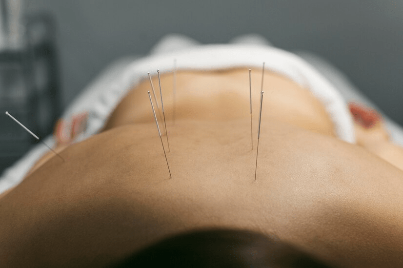 Best Acupuncture And Massage Therapy In Edmonton