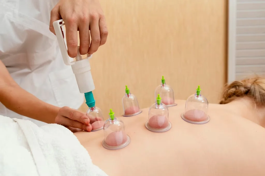 Best Cupping Therapy And Other Massage Services In Edmonton